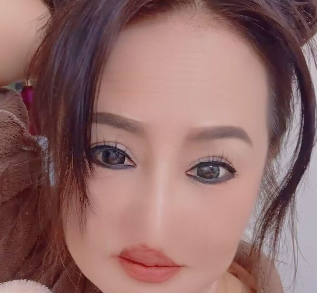 合肥雪莲